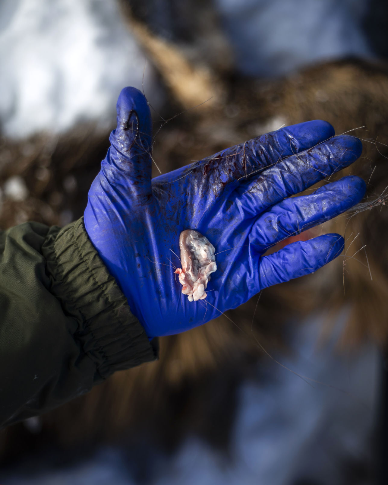 CWD lymph node